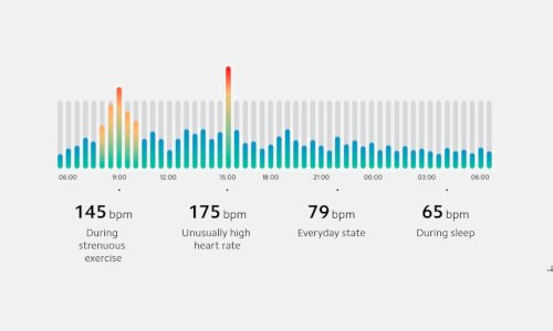 24ωρη παρακολούθηση καρδιακού ρυθμού