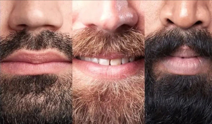 Ξεχάστε την τριχοφυΐα