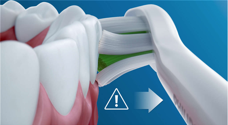Η προηγμένη τεχνολογία sonic της Philips Sonicare